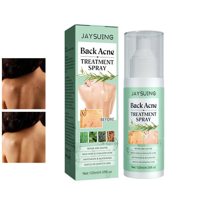 Back Acne Treatment Spray