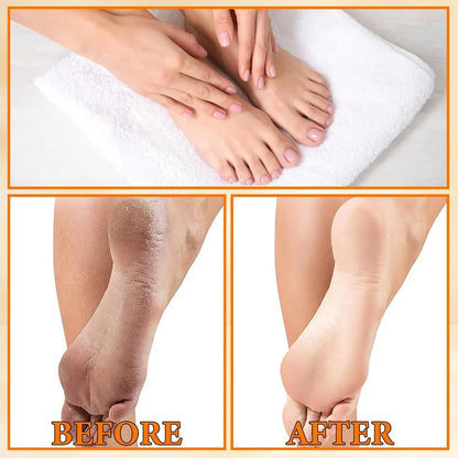 EELHOE Foot Peeling Spray